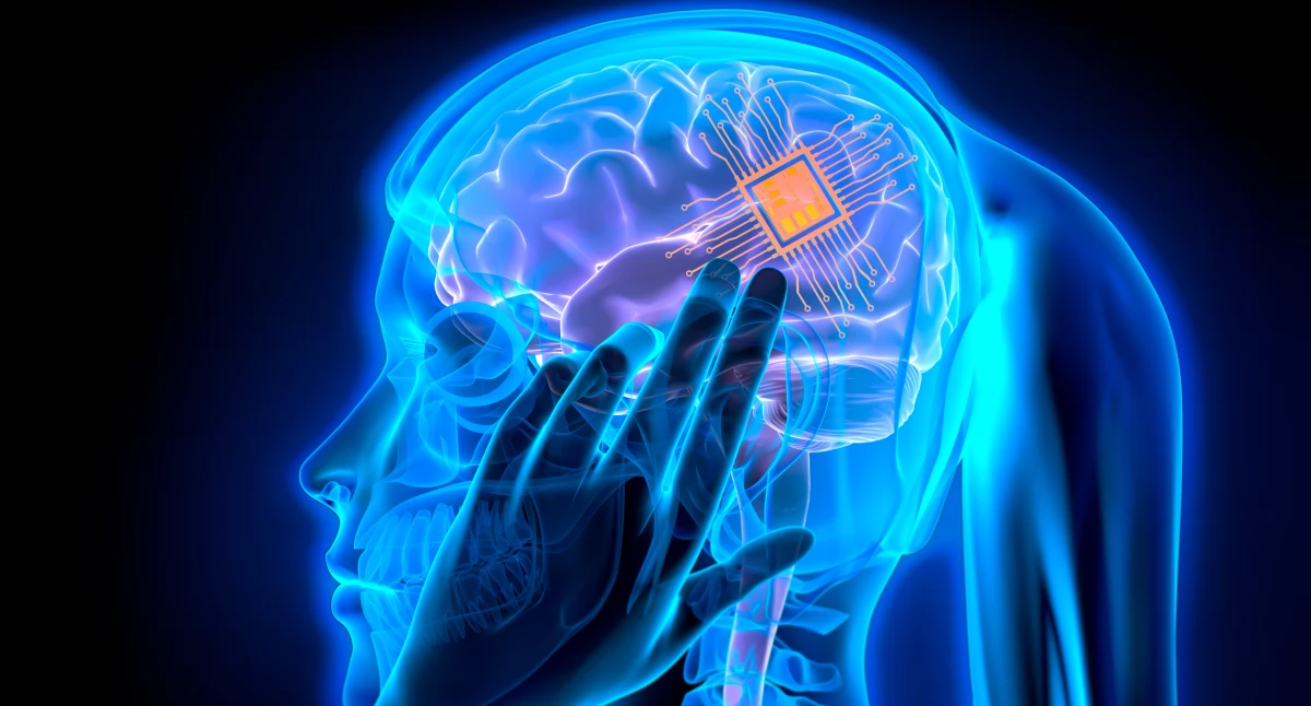 Nowe technologie medyczne, Drugi implant Neuralink wszczepiony Problem pierwszego powtórzył - zdjęcie, fotografia