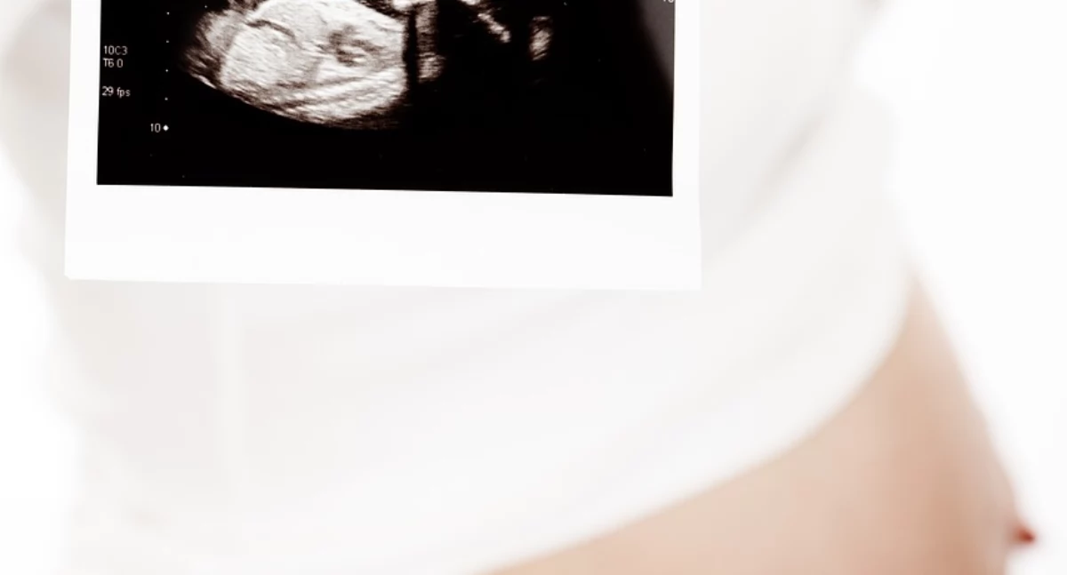 Zawody medyczne, #MedycznyAngielski ciąża naucz przydatnych słówek - zdjęcie, fotografia
