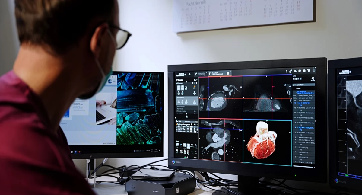 Zdrowe życie, Narodowy Instytut Kardiologii czele nowoczesnej diagnostyki serca - zdjęcie, fotografia