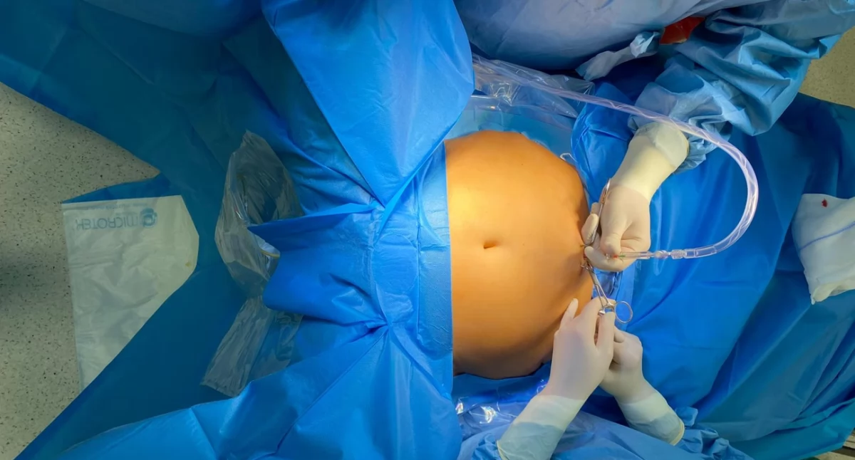 Zdrowe życie, Unikalna operacja urologiczna Polsce zabieg wykonano wejherowskim szpitalu - zdjęcie, fotografia