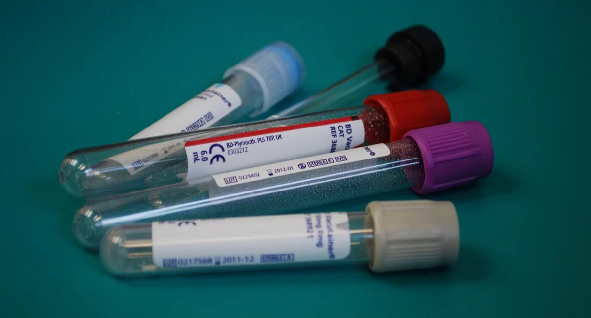 Inwestycje, Inwestorzy zdiagnozują Diagnostykę [FELIETON] - zdjęcie, fotografia