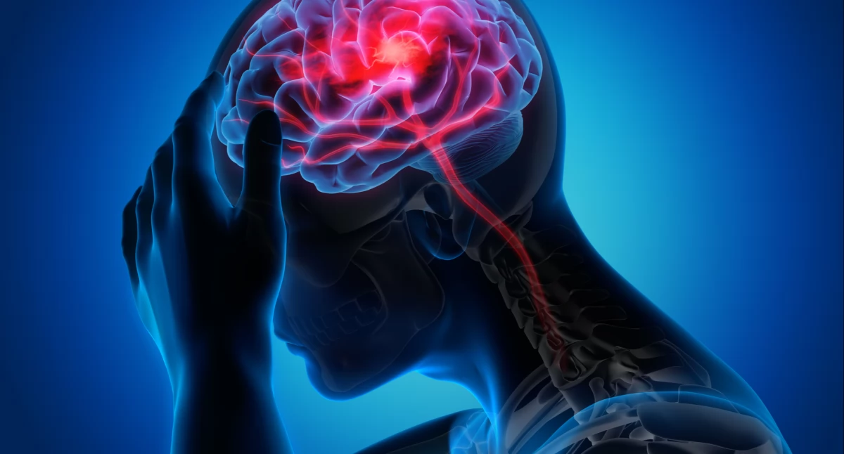 Leczenie, terapie, tysięcy Polaków choruje epilepsję udzielić pomocy trakcie napadu padaczkowego - zdjęcie, fotografia