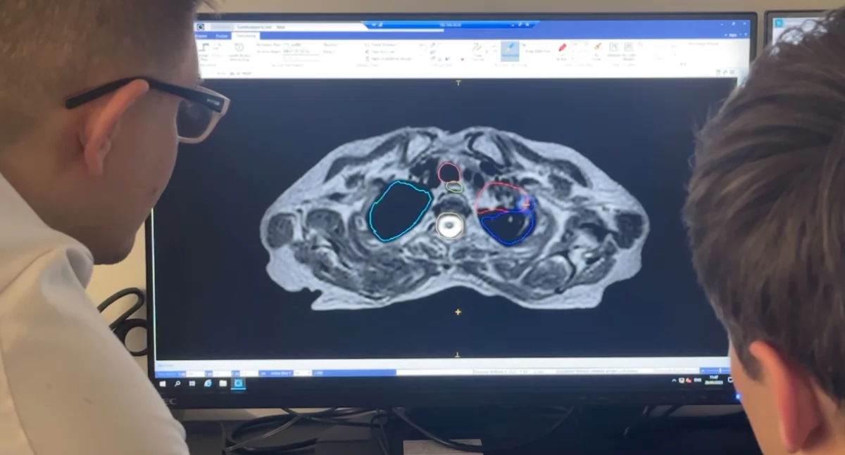 Nowe technologie medyczne, Przełom walce nowotworami Centrum Onkologii Bydgoszczy urządzenie ratuje dziesiątki chorych miesięcznie! - zdjęcie, fotografia