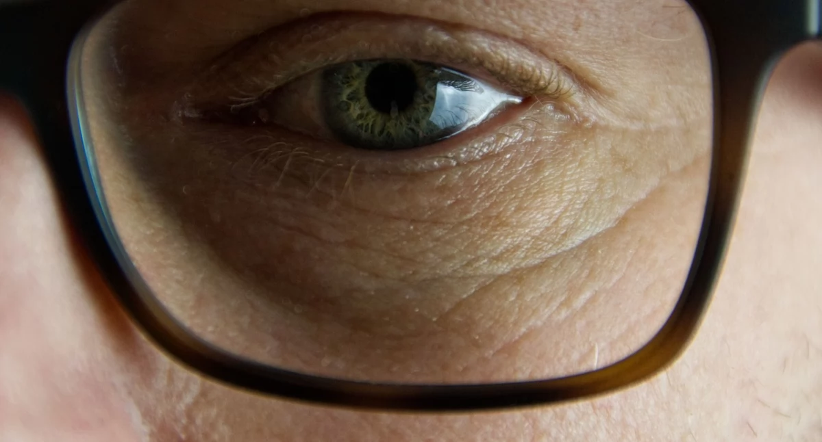 Wyceny, fundusze, refundacje, wadę wzroku może pokryć Twoje wydatki okulary korekcyjne soczewki kontaktowe - zdjęcie, fotografia