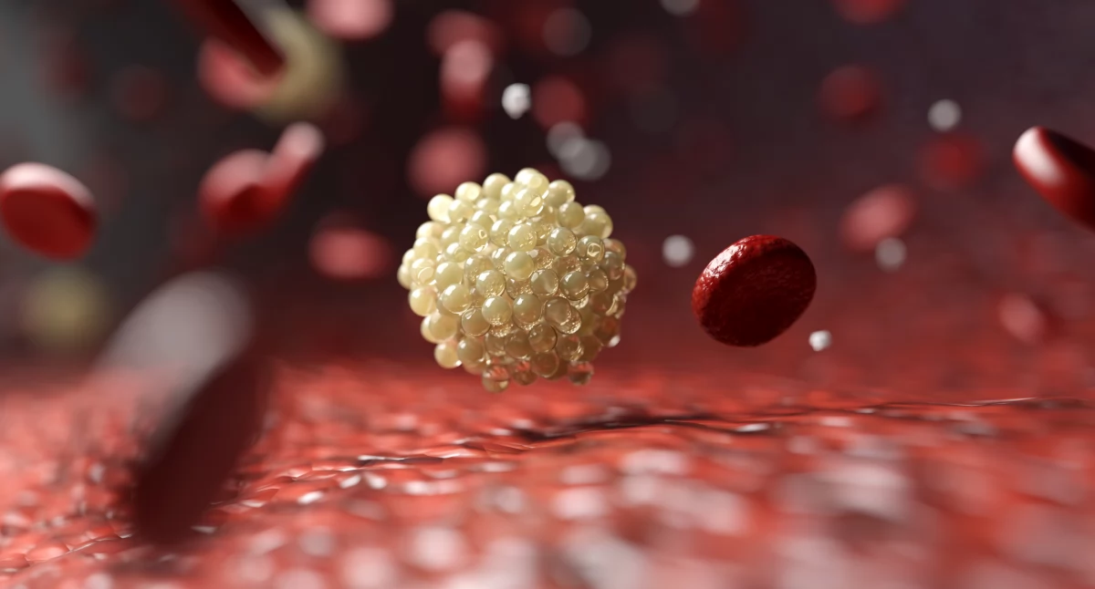 Zdrowe życie, cholesterol najgroźniejszy badać lipoproteinę - zdjęcie, fotografia