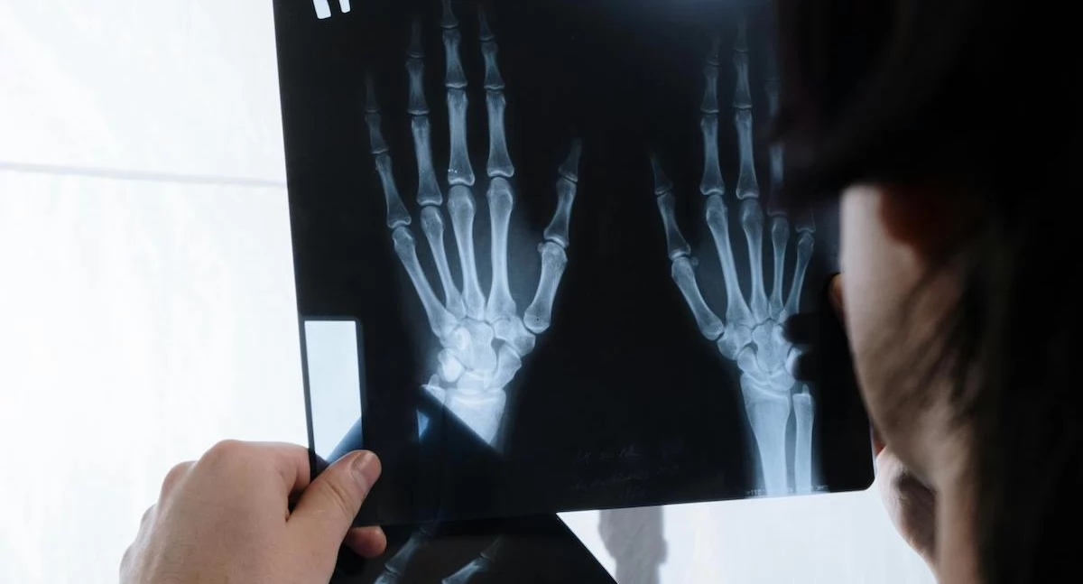 Zdrowe życie, Choroby reumatyczne atakują coraz młodszych Opieka diagnoza Polsce mocno kuleją - zdjęcie, fotografia