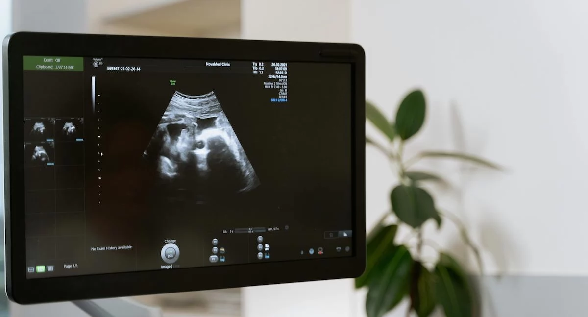 Zdrowe życie, Prawnicy mają wątpliwości Uśmiercenie płodu zdolnego życia przestępstwo - zdjęcie, fotografia