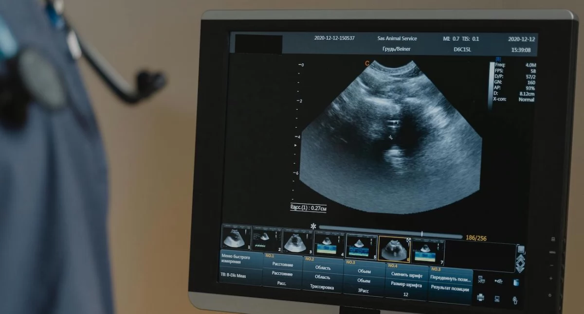 Zdrowe życie, Legalna aborcja ogniu nagonki Ginekolożka szpitala Oleśnicy presją radykałów - zdjęcie, fotografia