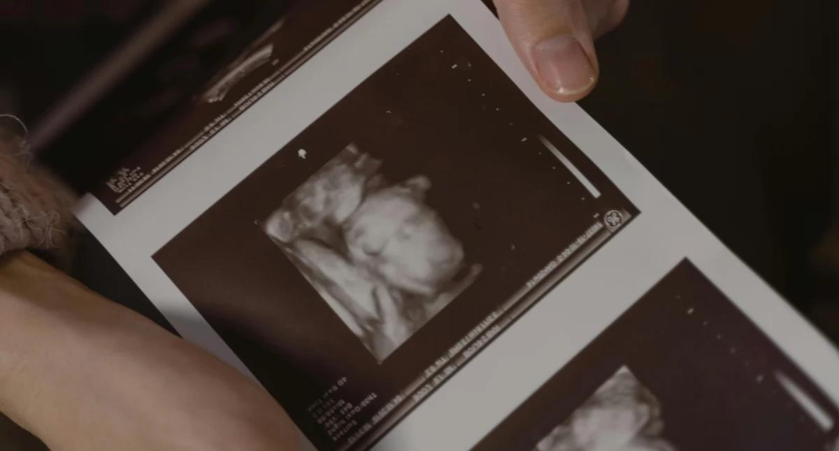 W rządzie, w parlamencie , Konieczny zagrożone zdrowie kobiety przepisy regulują terminu przerwania ciąży - zdjęcie, fotografia