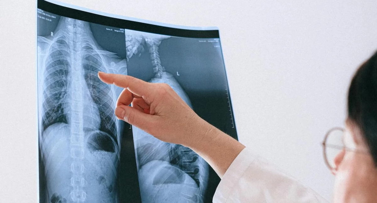 Zdrowe życie, Diagnostyka onkologiczna nadal Eksperci alarmują pacjenci czekają długo - zdjęcie, fotografia