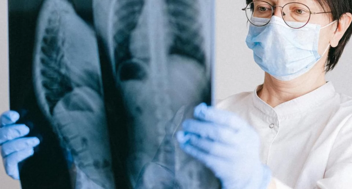 Badania kliniczne, nadzieja chorych włóknienie płuc Obiecujące wyniki badań nerandomilastem - zdjęcie, fotografia