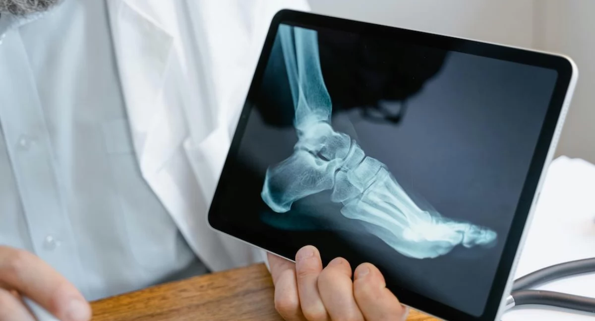Firmy i instytucje, Łódź mówi się! rusza program wczesnego wykrywania osteoporozy - zdjęcie, fotografia