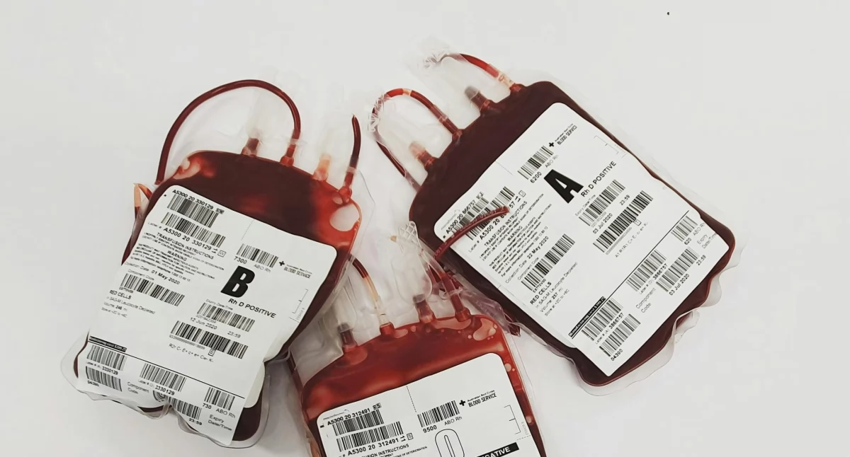 Leczenie, terapie, Anemia objawy leczenie niedokrwistości - zdjęcie, fotografia