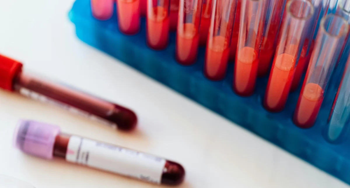 Nowe technologie medyczne, Substytut NanoGroup polska innowacja ratująca życie walki medycynie ratunkowej - zdjęcie, fotografia