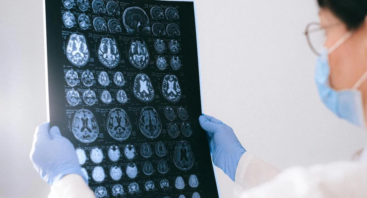 Zdrowe życie, Światowy Dzień Mózgu Neurolodzy biją alarm reform opieka neurologiczna Polsce załamie - zdjęcie, fotografia