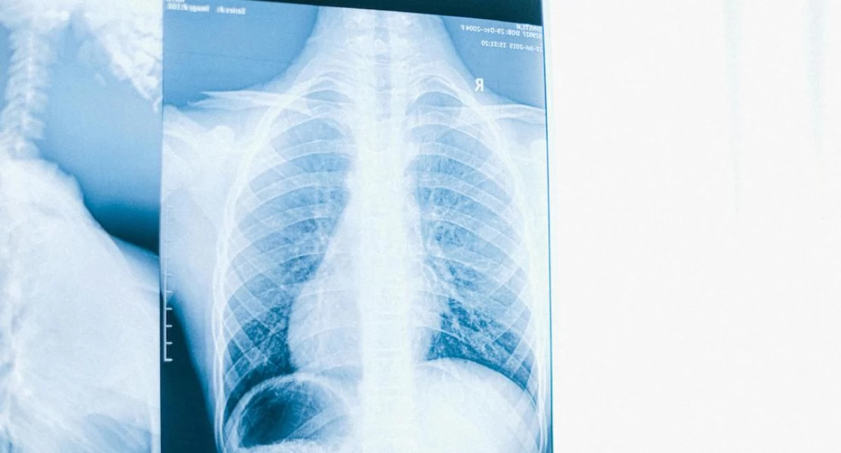 Badania kliniczne, Wdychamy mikroplastik Naukowcy wykazali może prowadzić płuc - zdjęcie, fotografia