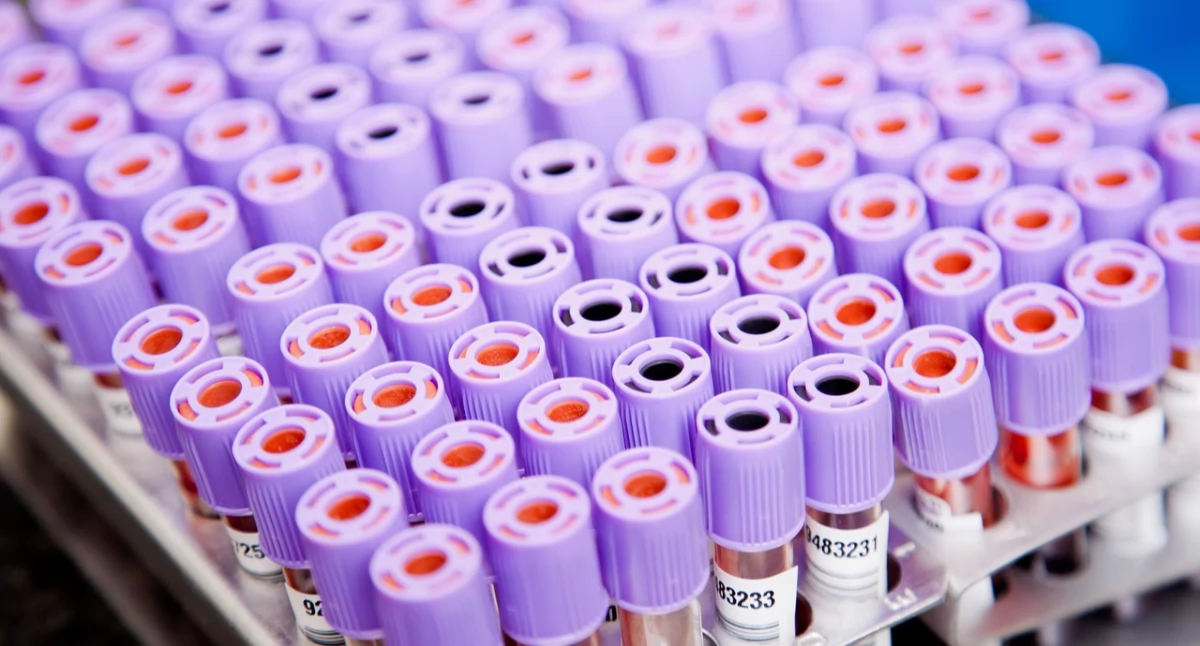 Badania kliniczne, Gotowa immunoterapia może zmienić leczenie jajnika - zdjęcie, fotografia