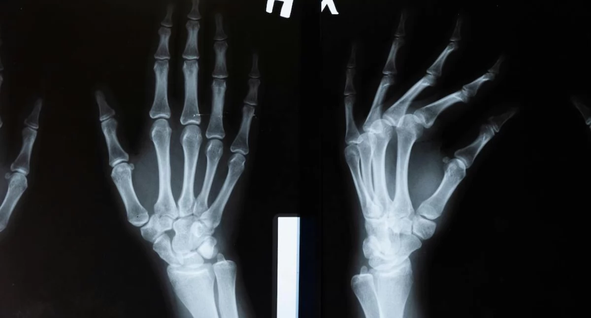 Badania kliniczne, radiolodzy razem skuteczniejsi hybrydowa metoda mammografii - zdjęcie, fotografia