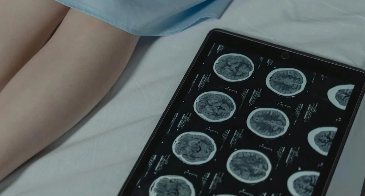 Badania kliniczne, Immunoterapia wydłuża życie chorych startuje kolejna odsłona kampanii edukacyjnej - zdjęcie, fotografia