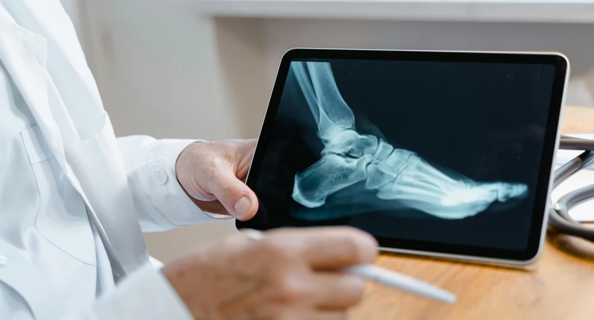 Badania kliniczne, leczeniu osteoporozy receptor GPR133 Przełom Lipska oznacza polskich pacjentów - zdjęcie, fotografia