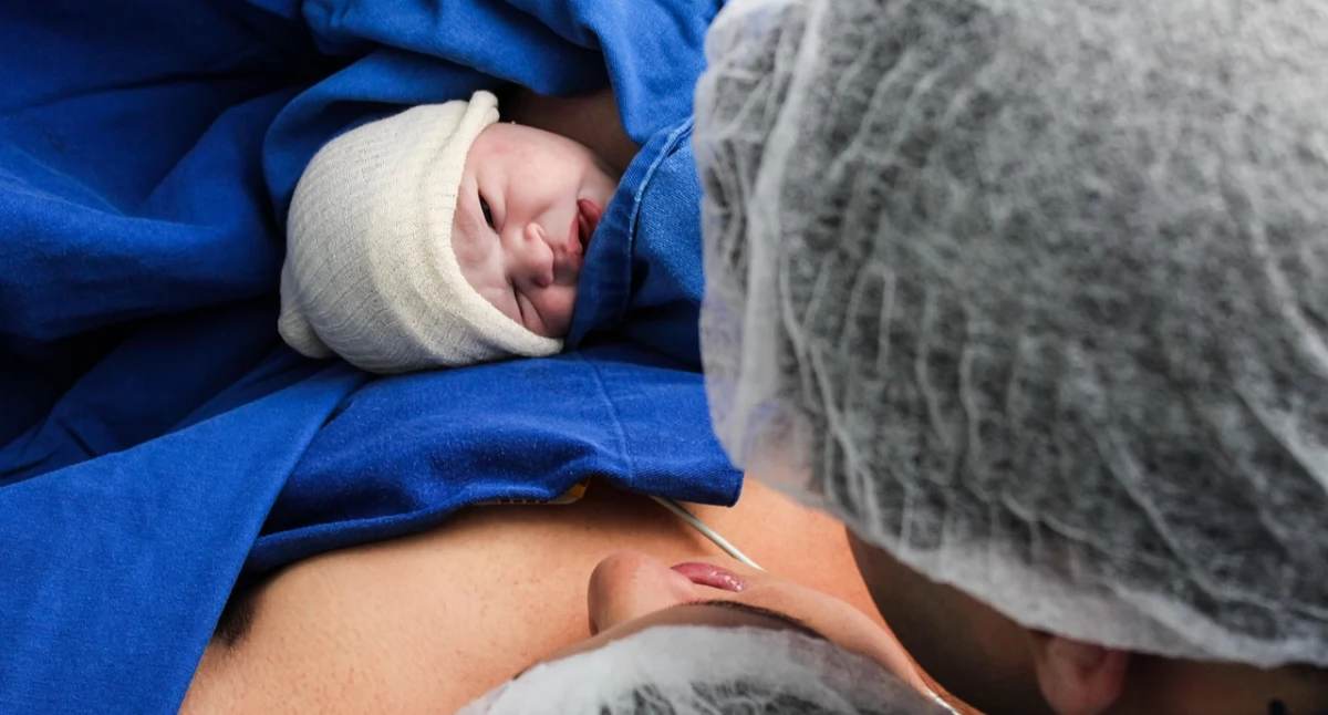 Badania kliniczne, Cesarskie cięcie może zwiększać ryzyko bezsenności bólu porodzie - zdjęcie, fotografia