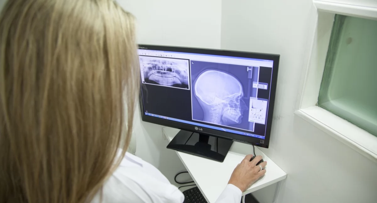 Badania kliniczne, pomaga rakowi ustnej przetrwać chemioterapię odkrycie naukowców - zdjęcie, fotografia