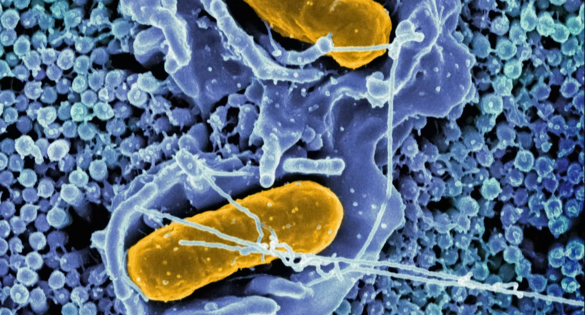 Dobre praktyki, Badanie mikrobiomu jelitowego standard diagnostyczny Ekspert wyjaśnia dziś możliwe - zdjęcie, fotografia