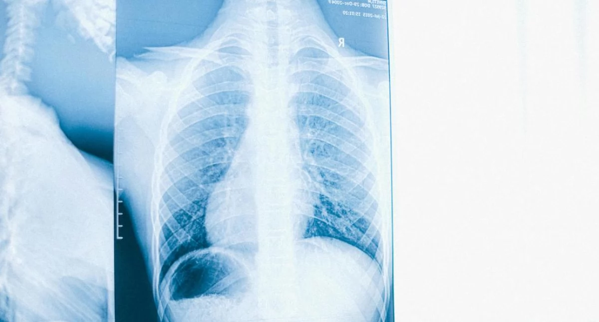 Badania kliniczne, Naukowcy Polski pracują maseczką wykrywającą płuc - zdjęcie, fotografia