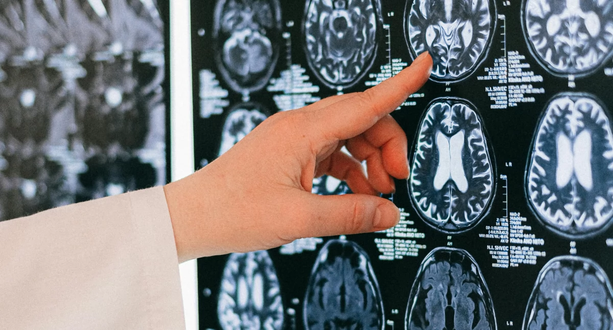 Leczenie, terapie, pacjentów dostępu leczenia Grzegorz Rosiak  „Radiologia interwencyjna przyszłość której jeszcze mamy” - zdjęcie, fotografia