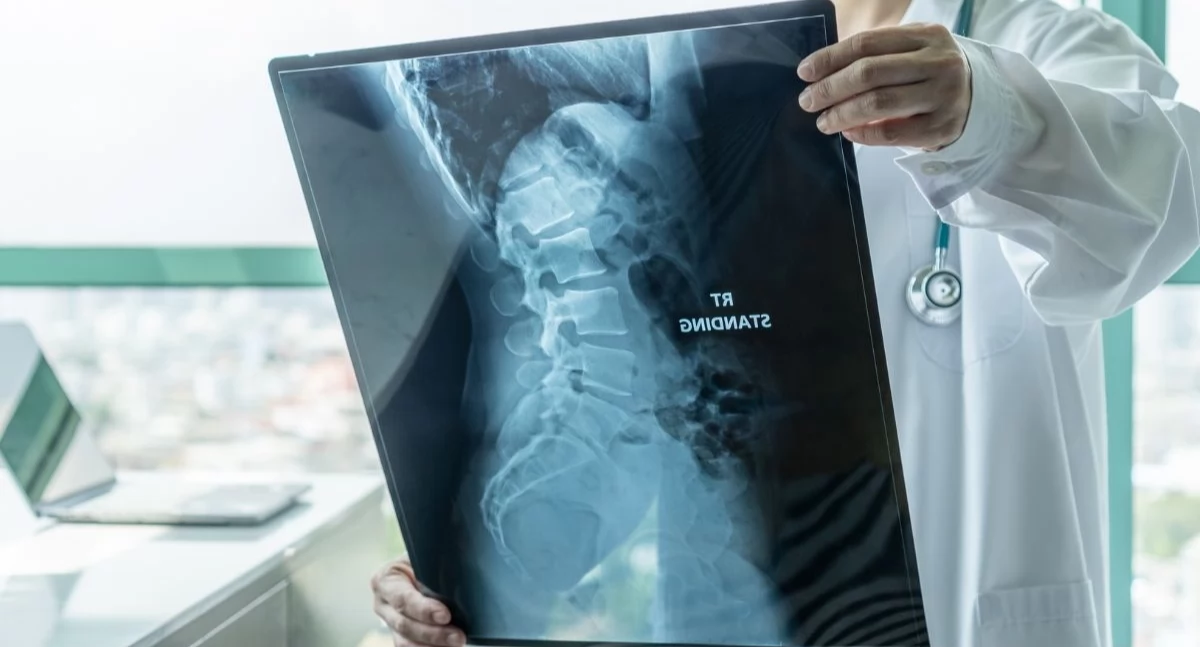 Raporty, analizy, rankingi, Świetne wyniki programu lekowego Skuteczność leczenia chorych niemal procent - zdjęcie, fotografia