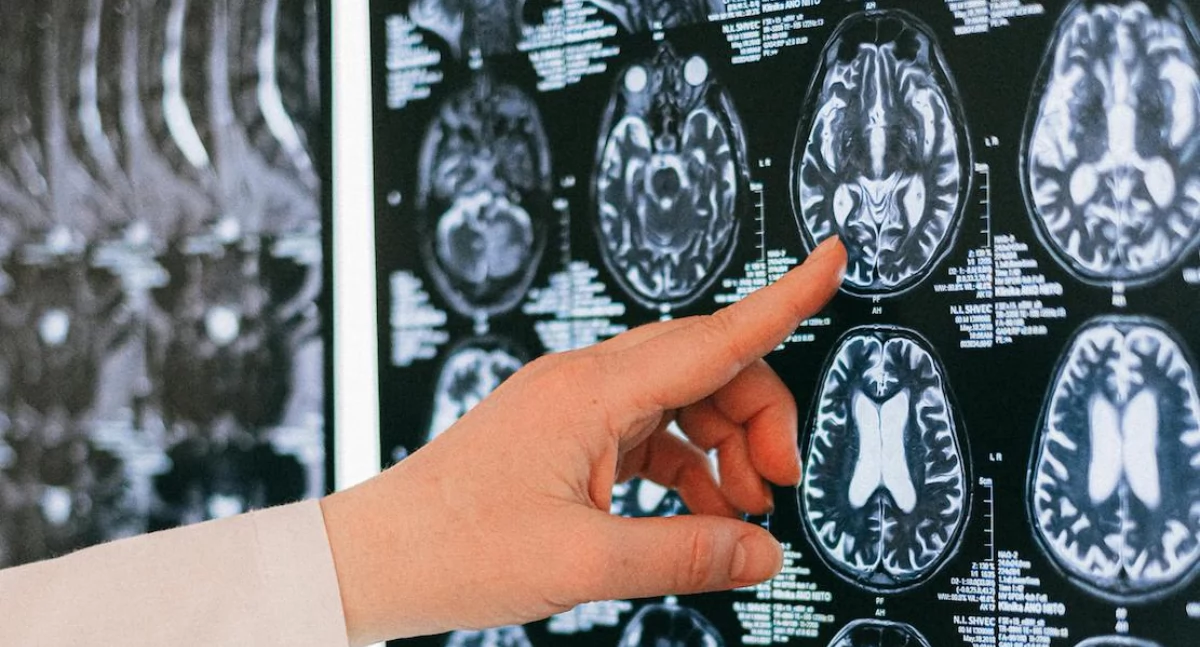 Badania kliniczne, Ultradźwięki połączeniu chemioterapią wydłużają życie pacjentów glejakiem - zdjęcie, fotografia
