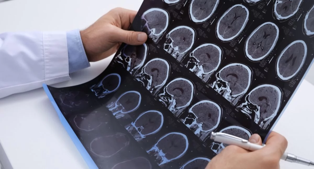 Najbardziej obiecujące wyniki dotyczą chorób neurodegeneracyjnych i autoimmunologicznych. Foto. Canva