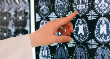 Światowy Dzień Mózgu. „Choroby neurologiczne dotyczą nawet 1 na 3 osoby”. Badanie u ponad 1000 seniorów daje nadzieję